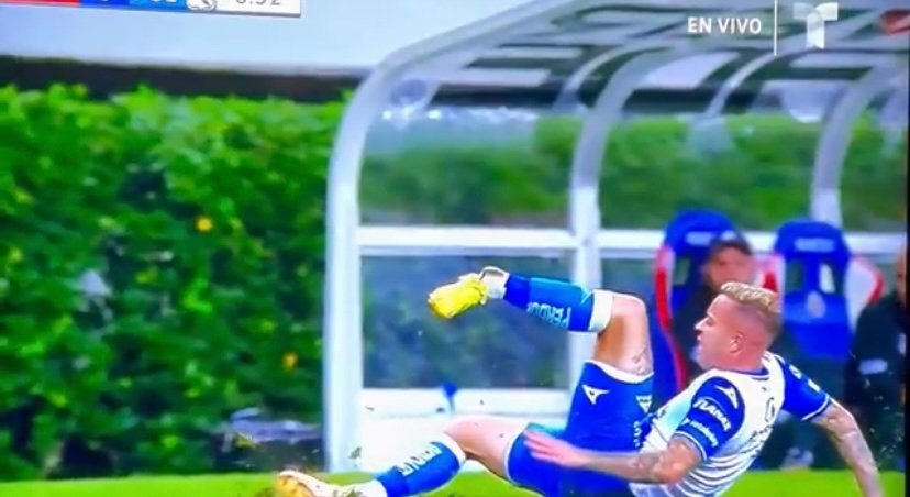 Jogador brasileiro sofre lesão assustadora no Campeonato Mexicano