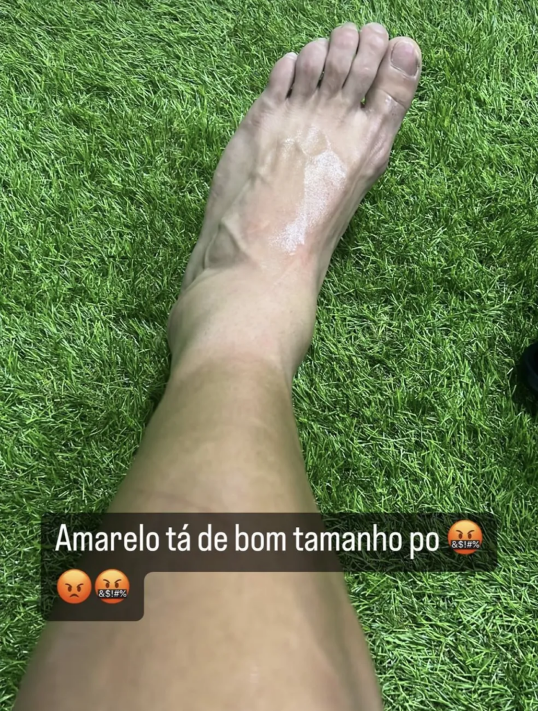 A Raposa deve ter sua primeira baixa logo a partir da 2º rodada do Mineiro. Mateus Vital deve desfalcar o Cruzeiro por cerca de um mês.